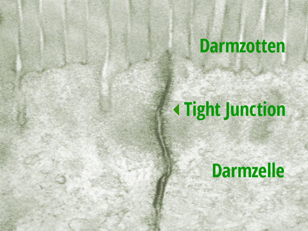Elektronenmikroskop-Foto: Darmgewebe-Querschnitt mit Darmzotten, Darmzellen und Leaky Gut Tight Junction. © Fawcett DW, The Cell: An Atlas of Fine Structure, WB Saunders, Philadelphia, 1966, p. 367.