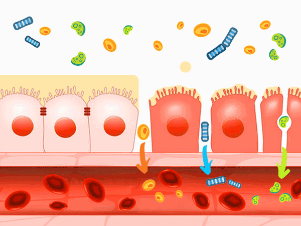 Schaubild: Leaky Gut Syndrom heilen. Vergleich: Links Leaky Gut Syndrom mit Mucinverlust und offnen Darmporen, die Verdauungsenzyme, Toxine, Keime und Bakterien in den Körper einlassen. Rechts ein gesunder Darm, der vor Krankheit schützt.  © designua 123rf.com .