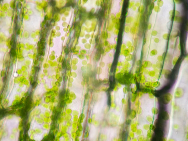 Zellen mit Chloroplasten. © sinhyu 123rf.com.