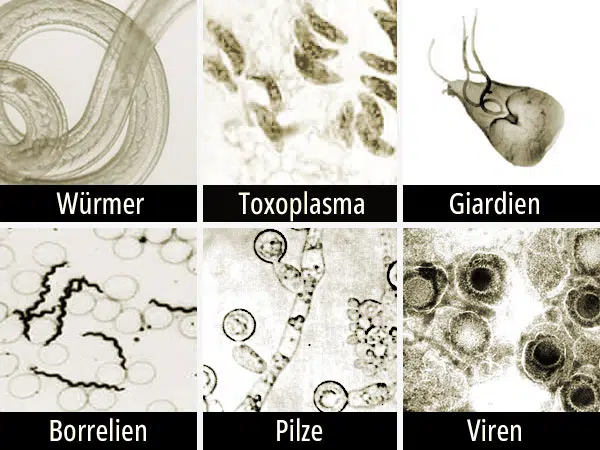 Mikrobielle Parasiten. Mikroskop-Fotos von Rundwurm, Toxoplsama, Giardia, Borrelien, Hefe Candida, Herpes Virion.