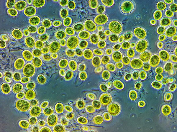 Elektronenmikroskop Foto: Chlorella Algen. Andrei Savitsky, CC BY 4.0 via Wikimedia Commons.