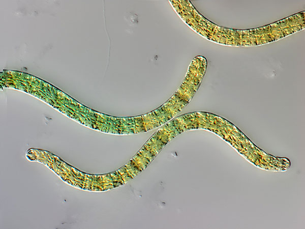Elektronenmikroskop Foto: Spirulina Blaualgen. 